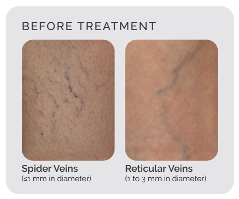 Procedure Illustration