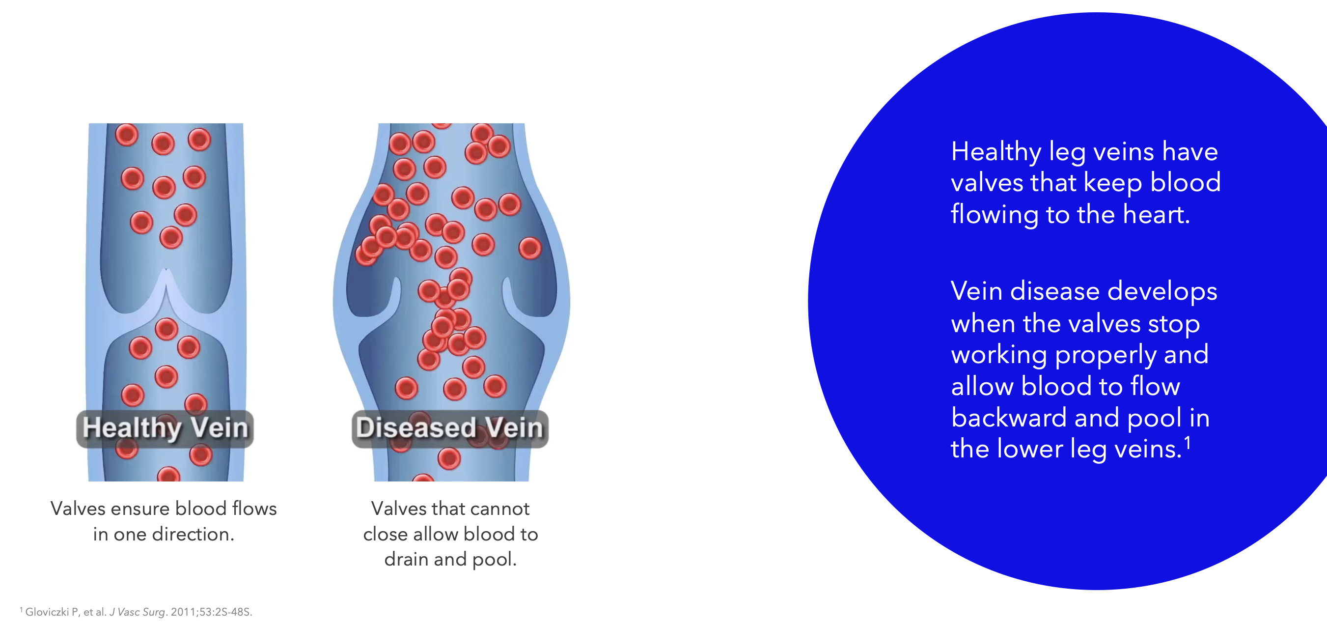 Procedure Illustration
