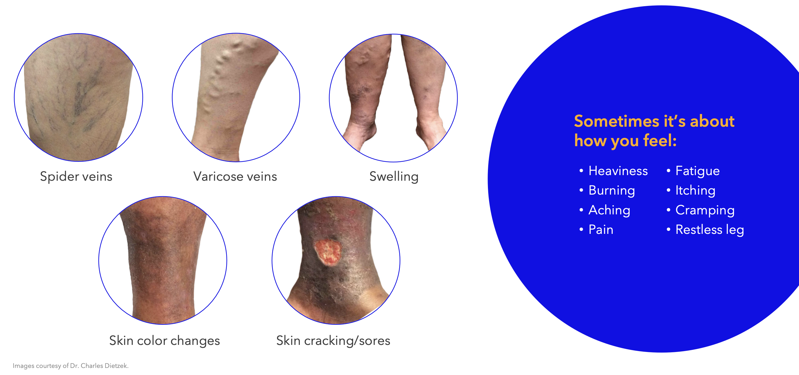 Procedure Illustration