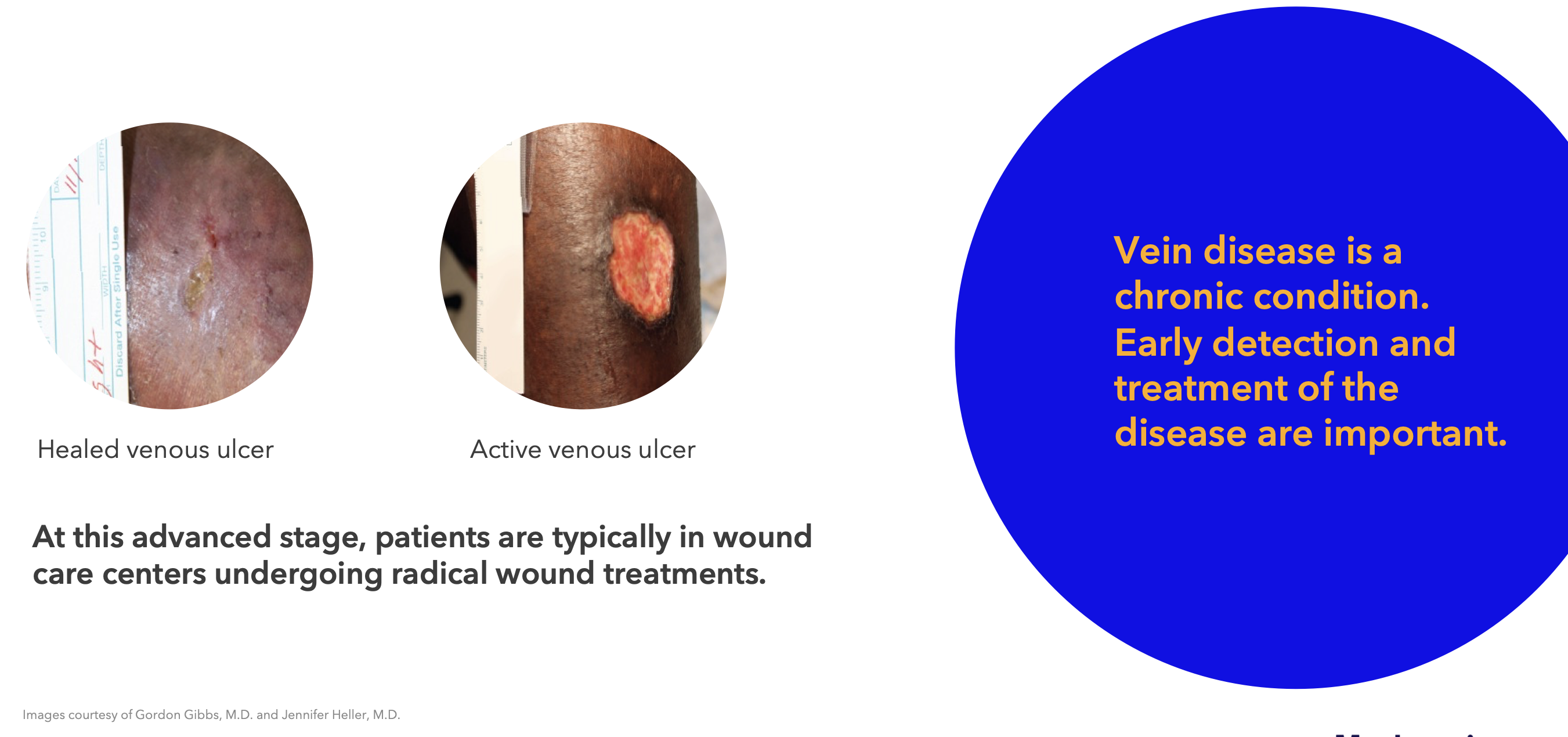 Procedure Illustration