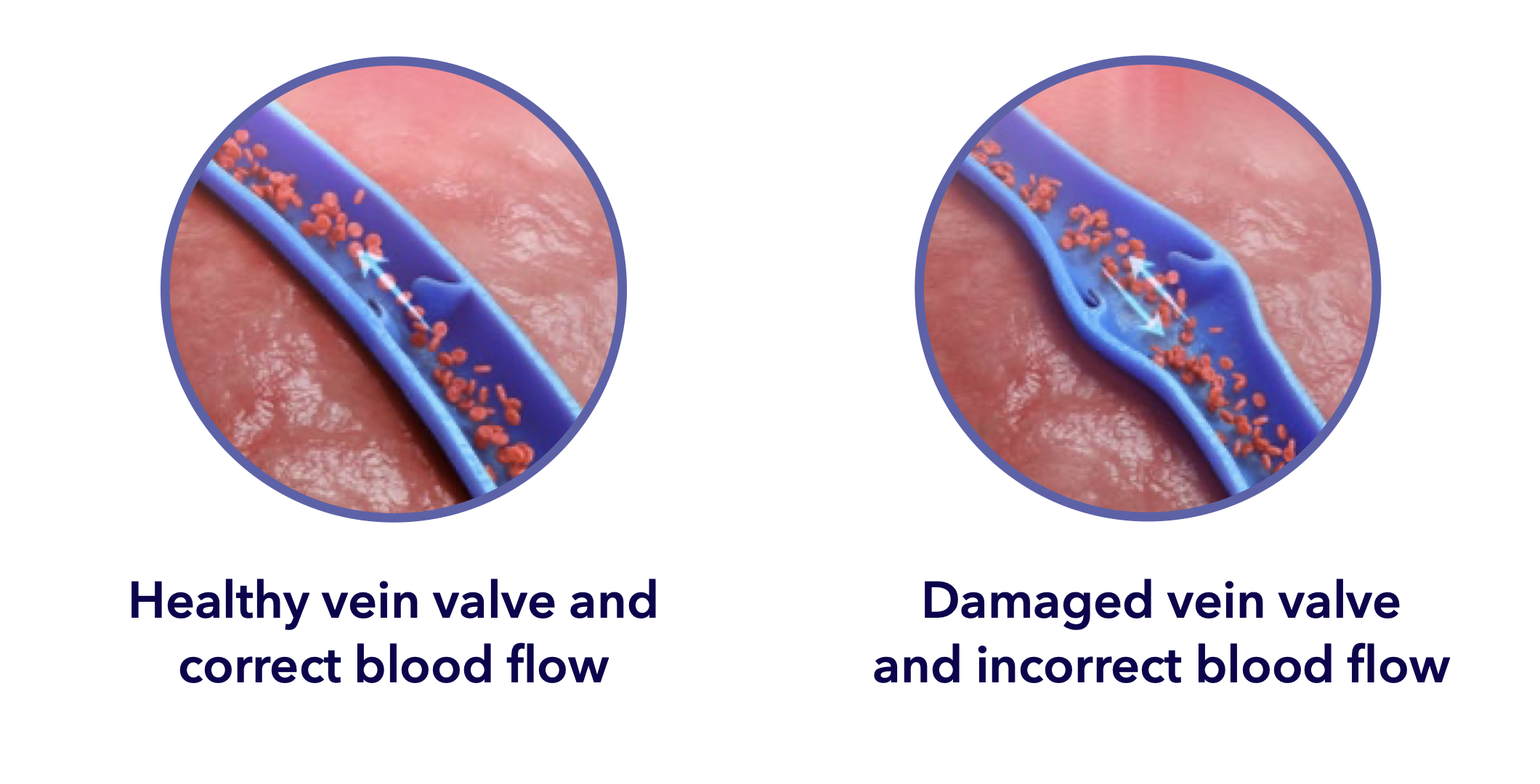 Procedure Illustration