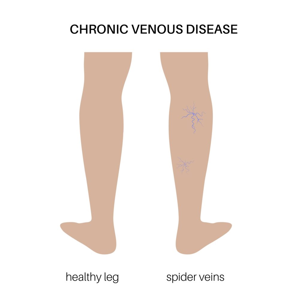 Procedure Illustration