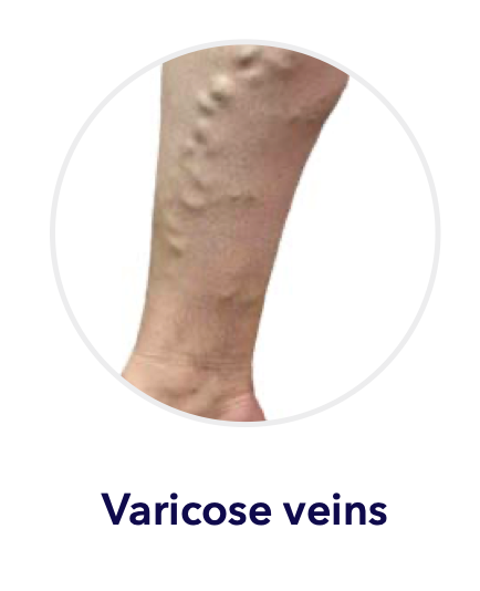 Procedure Illustration