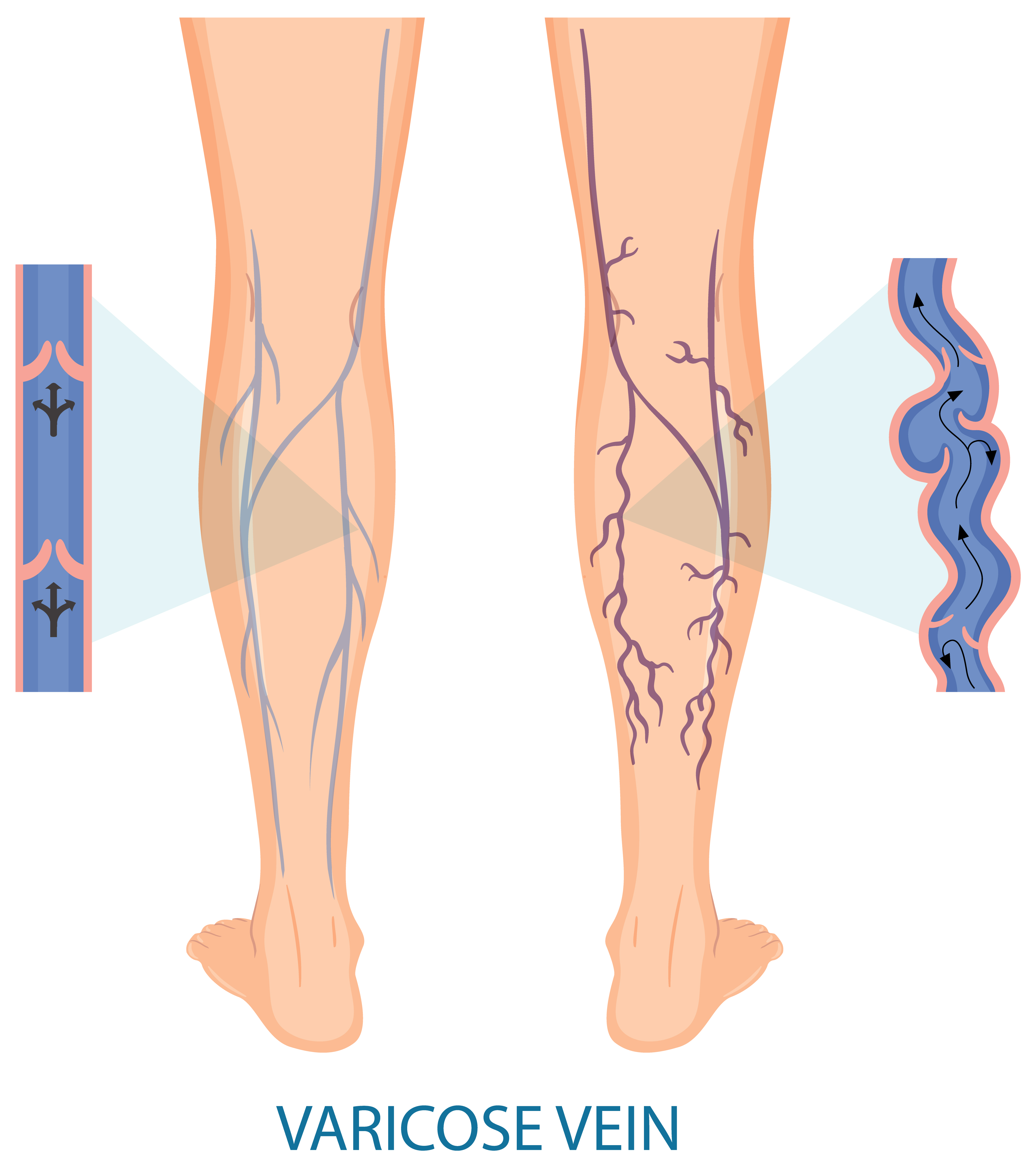 Procedure Illustration