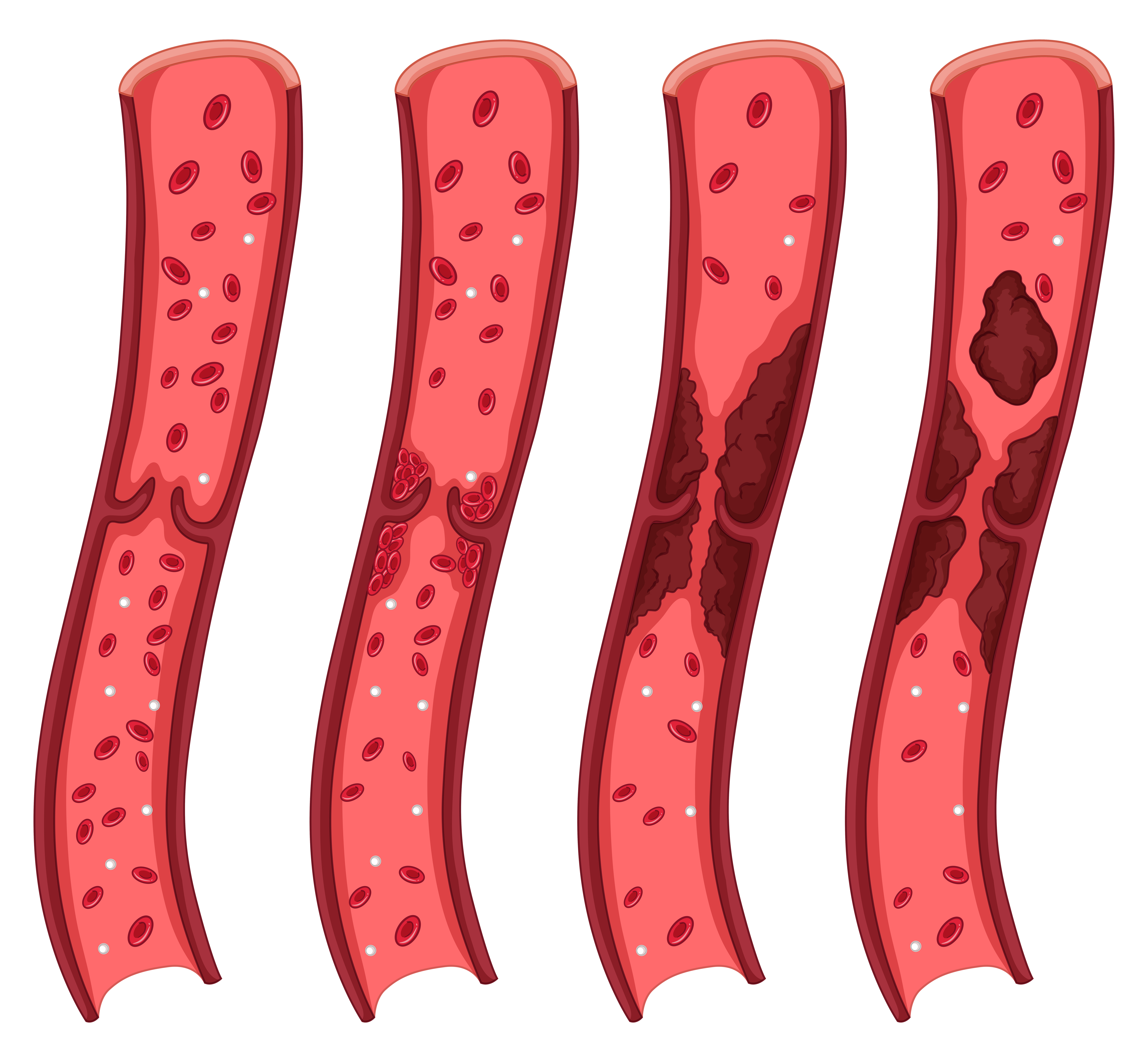 Procedure Illustration