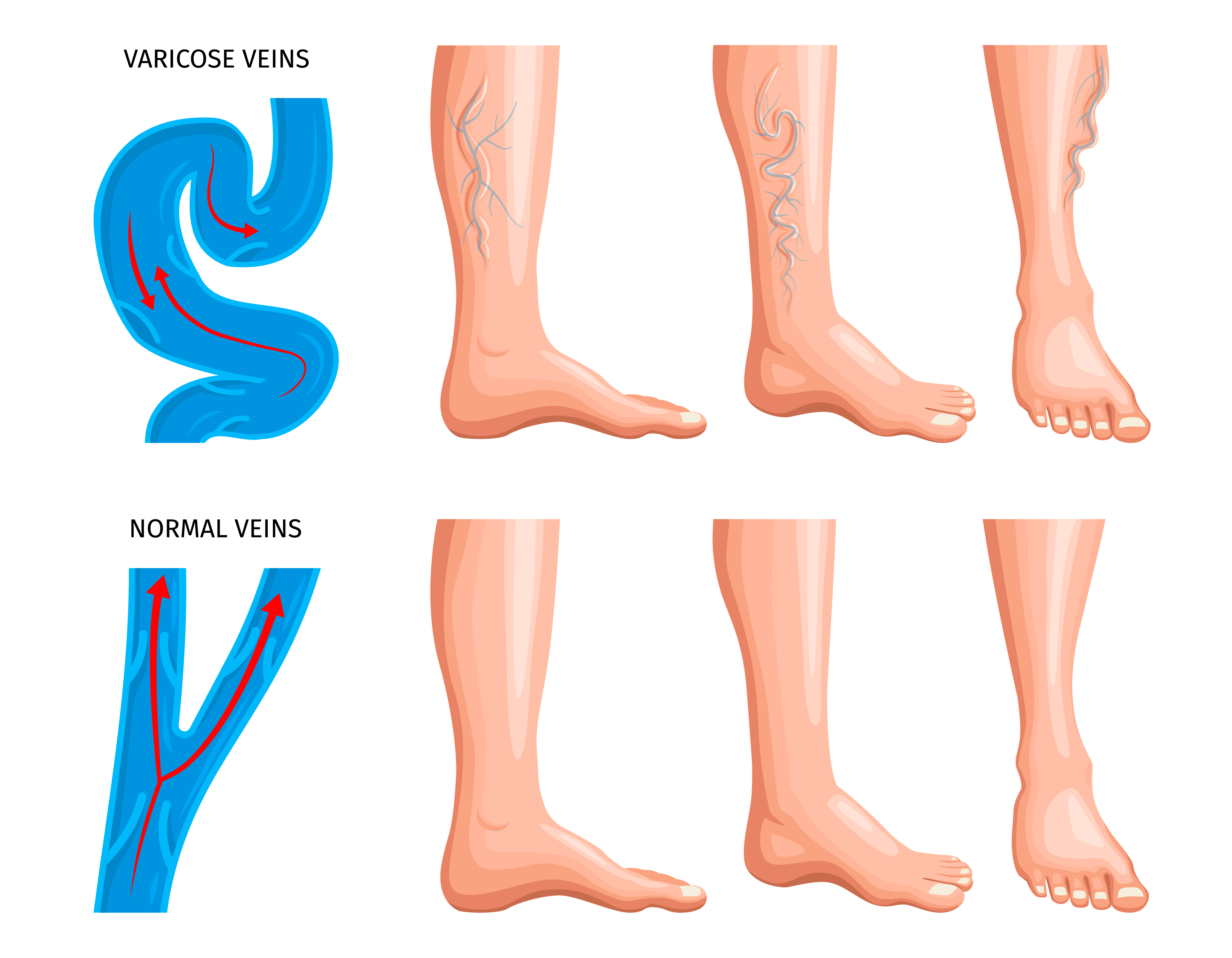 Procedure Illustration
